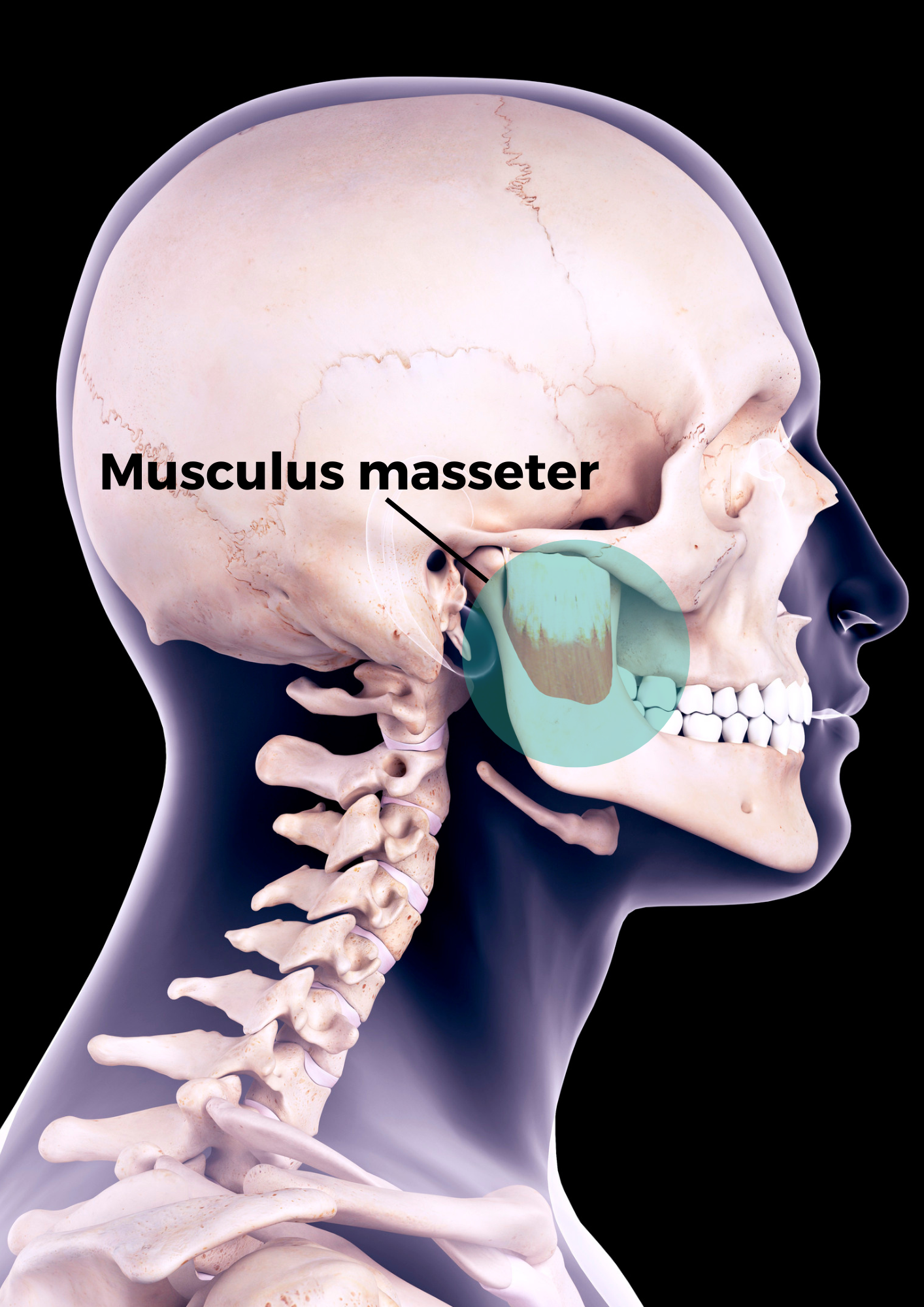 ...ist hauptsächlich verantwortlich für die typischen Bewegungen des Unterkiefers beim Knirscnen: Der Musculus masseter.