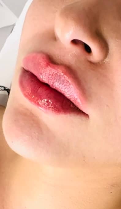 Harmonisches Lippenbehandlungsergebnis bei DOC.ALIAS